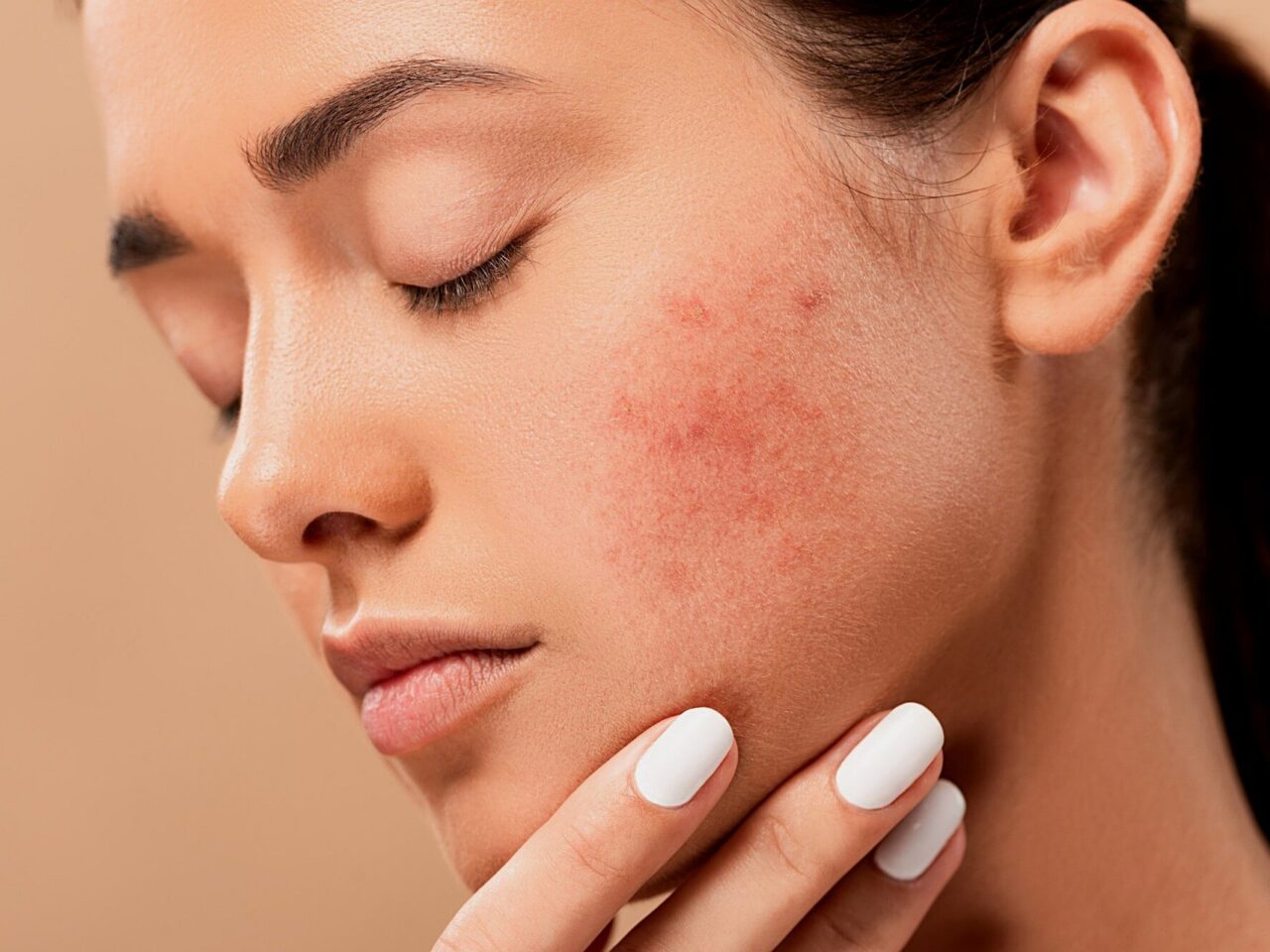 Damage after laser treatment is often a very intense experience.