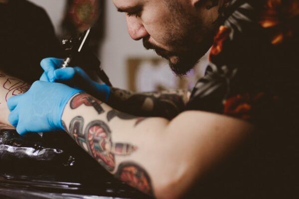 You can also have a tattoo removed with laser treatment.