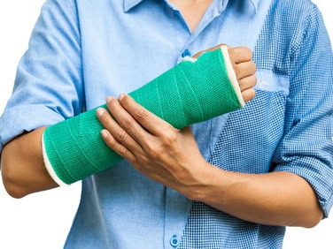 U kunt door een ongeval twee soorten botbreuken oplopen: een gesloten of open fractuur.